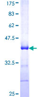 12.5% SDS-PAGE Stained with Coomassie Blue.